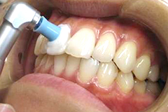 PMTC（Professional　Mechanical　Tooth　Cleaning）